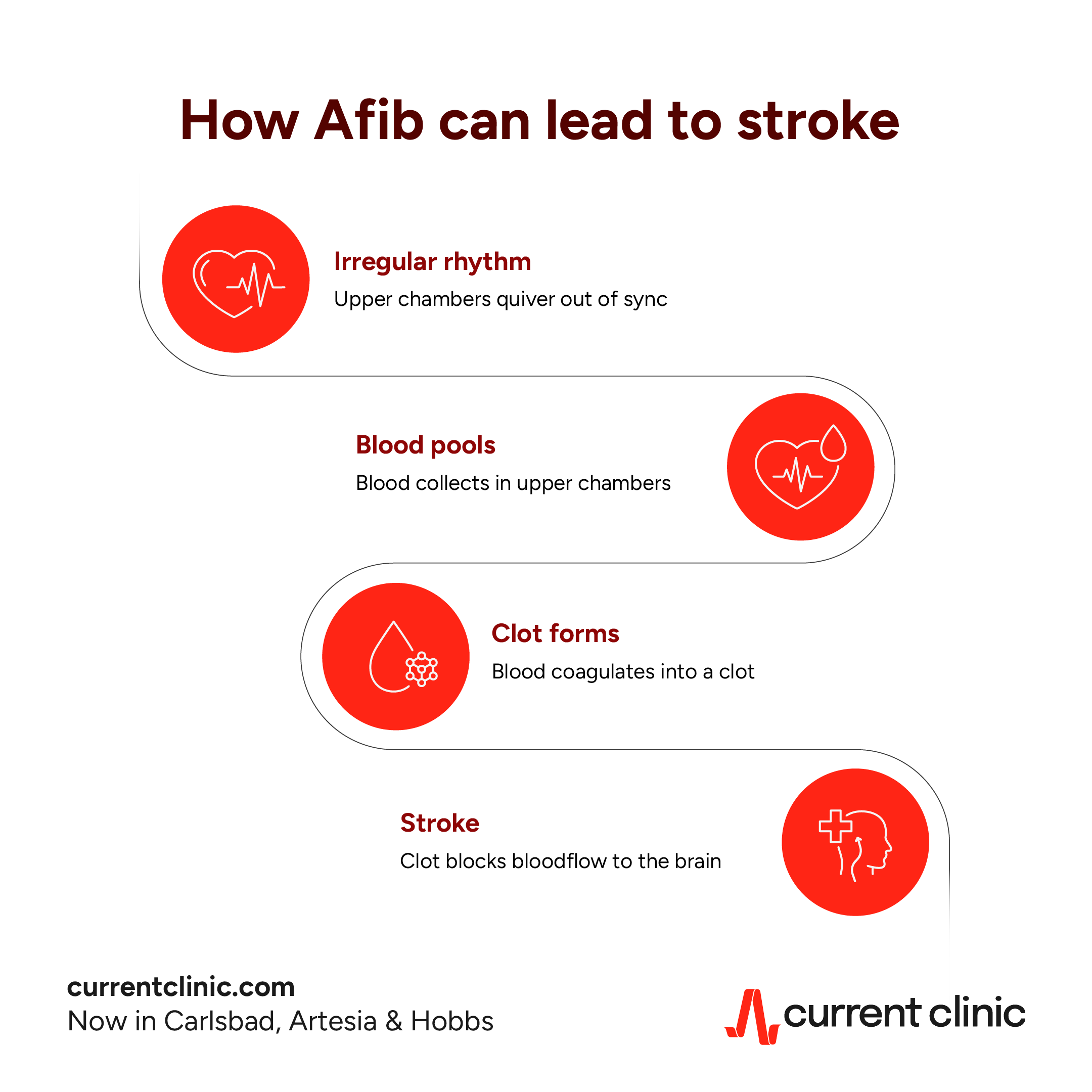 How Afib leads to stroke